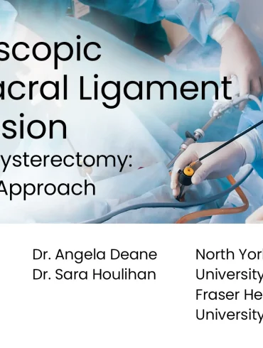 Laparoscopic Uterosacral Ligament Suspension at Time of Hysterectomy: A Stepwise Approach preview