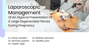 Laparoscopic Management Of An Atypical Presentation Of A Large Degenerated Fibroid During Pregnancy preview