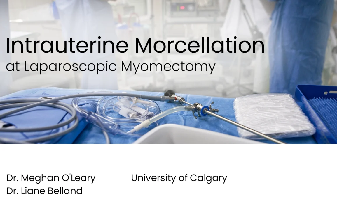 Intrauterine Morcellation at Laparoscopic Myomectomy