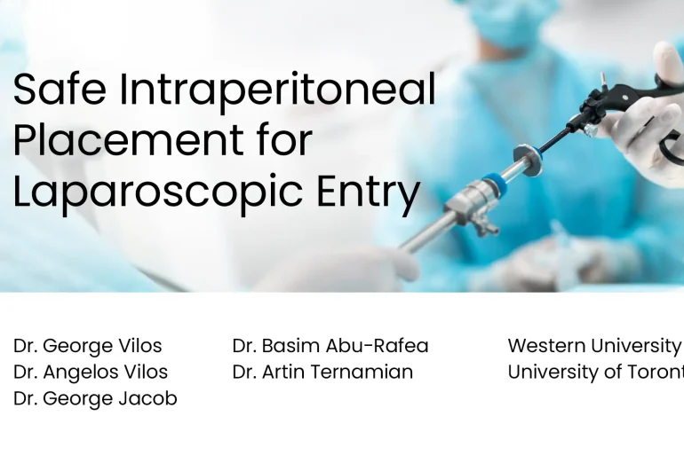 Safe Intraperitoneal Placement for Laparoscopic Entry preview