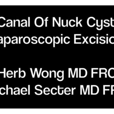 Canal Of Nuck Cyst Laparoscopic Excision