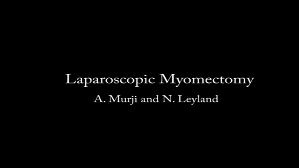 Laparoscopic Myomectomy | CanSAGE Videos