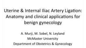 Uterine & Internal Iliac Artery Ligation: Anatomy and Clinical Applications for Benign Gynecology 35 This video reviews the surgical vascular anatomy and techniques for ligating the uterine arteries at their original, or the anterior division of the internal iliac arteries.