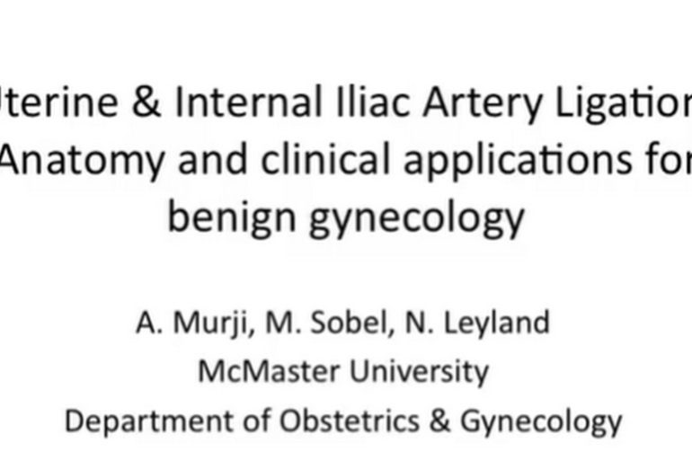 This video reviews the surgical vascular anatomy and techniques for ligating the uterine arteries at their original, or the anterior division of the internal iliac arteries.