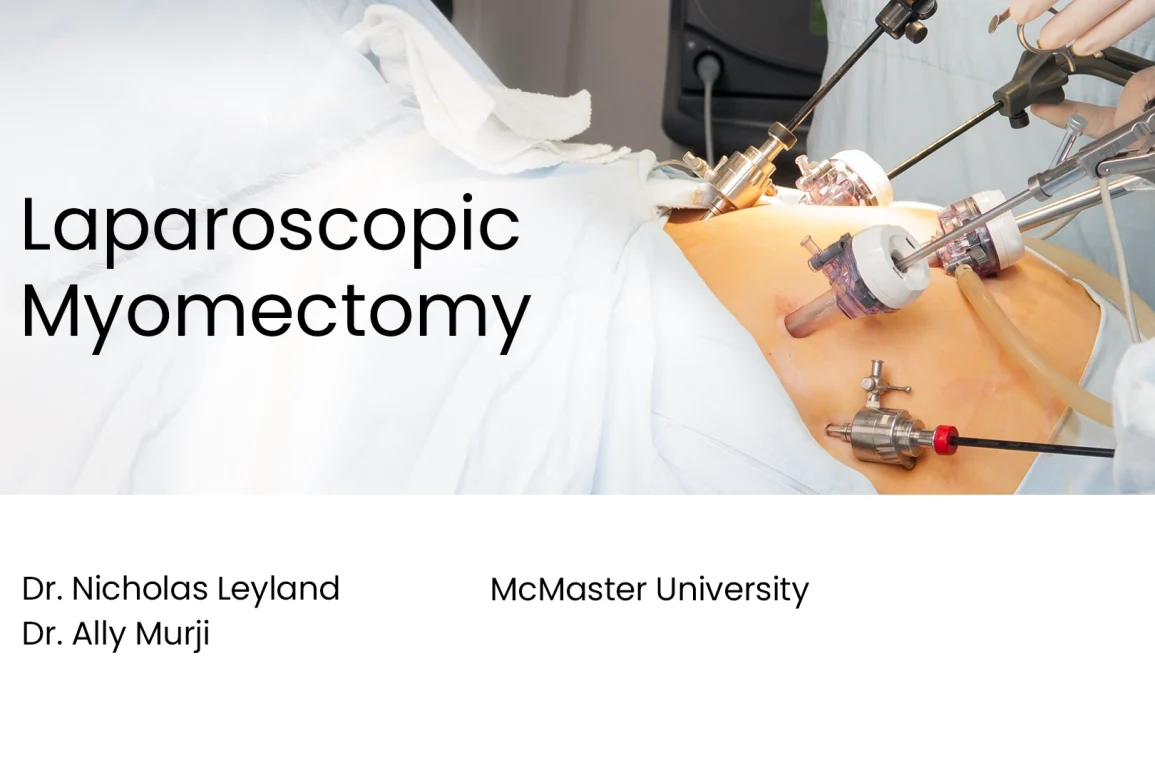 Laparoscopic Myomectomy