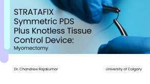 STRATAFIX Symmetric PDS Plus Knotless Tissue Control Device: Myomectomy 34 Stratafix technique