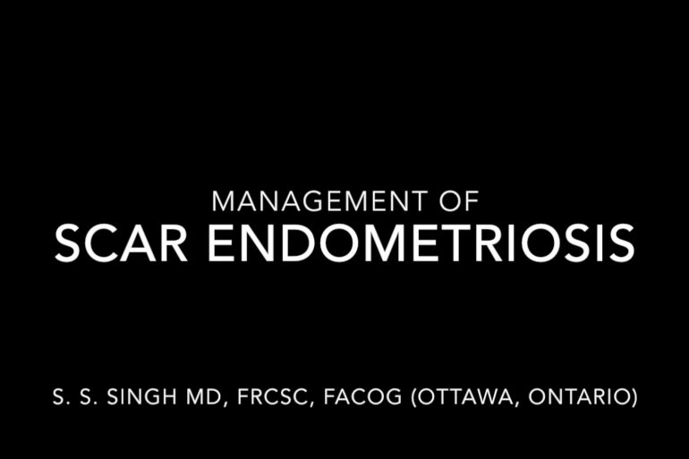 Management of Scar Endometriosis CanSAGE Videos