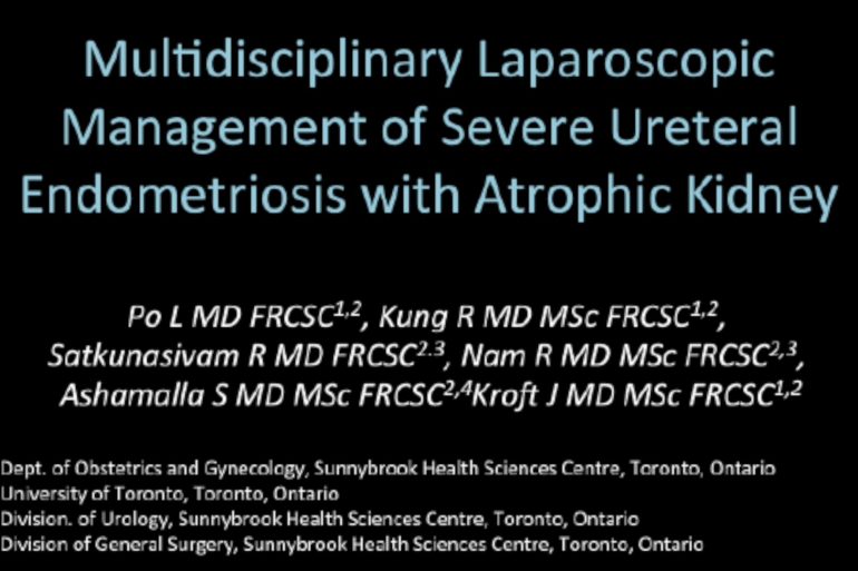 Multidisciplinary Laparoscopic Management of Severe Ureteral Endometriosis with Atrophic Kidney