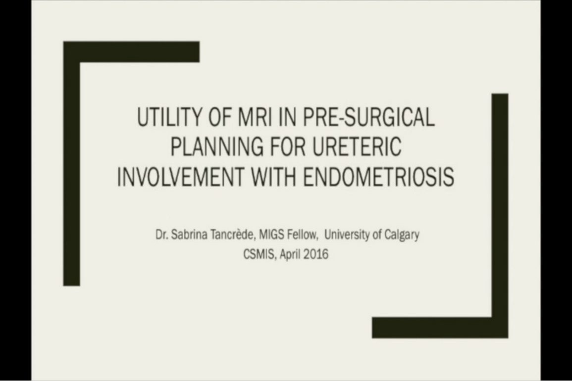 Utility of MRI in Pre-Surgical Planning for Ureteric Involvement with Endometriosis