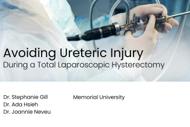 Avoiding Ureteric Injury during a Total Laparoscopic Hysterectomy