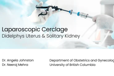 Laparoscopic Cerclage: Didelphys Uterus & Solitary Kidney