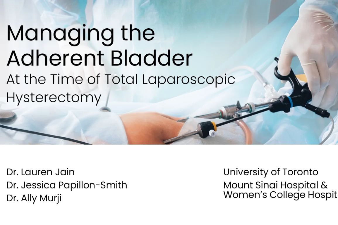 Managing the Adherent Bladder at the Time of Total Laparoscopic Hysterectomy