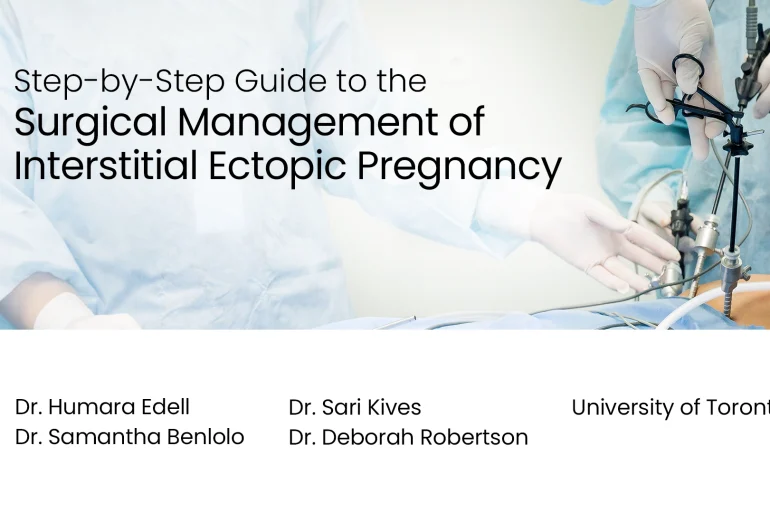 Step-by-Step Guide to the Surgical Management of Interstitial Ectopic Pregnancy