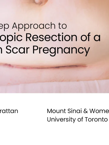 The Five-Step Approach to Laparoscopic Resection of a Cesarean Scar Pregnancy