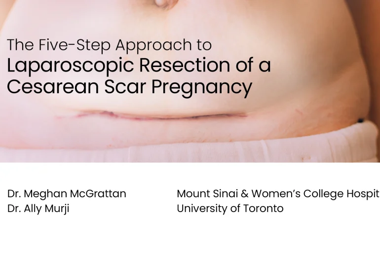 The Five-Step Approach to Laparoscopic Resection of a Cesarean Scar Pregnancy