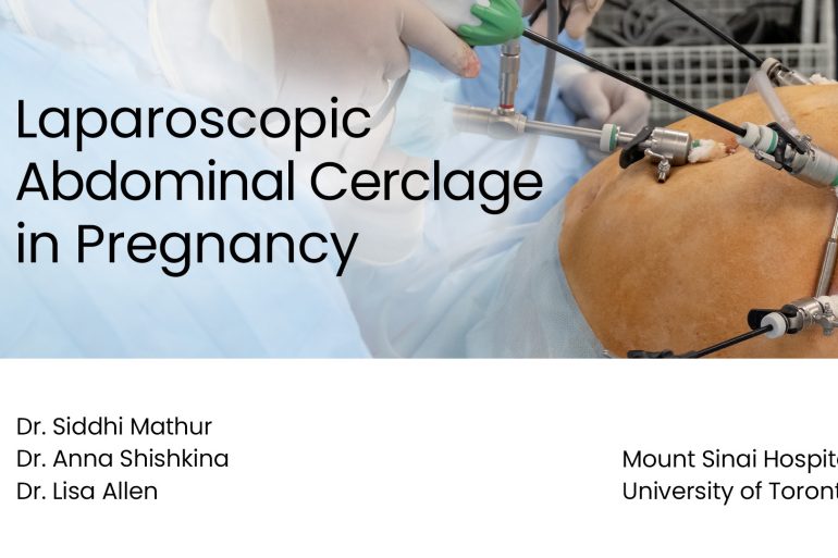 image of a cerclage surgery