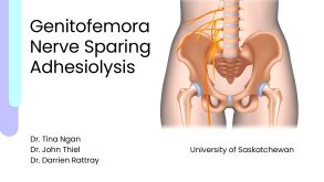 Genitofemoral Nerve Sparing Adhesiolysis