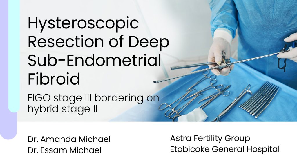 Hysteroscopic Resection Of Deep Sub Endometrial Fibroid