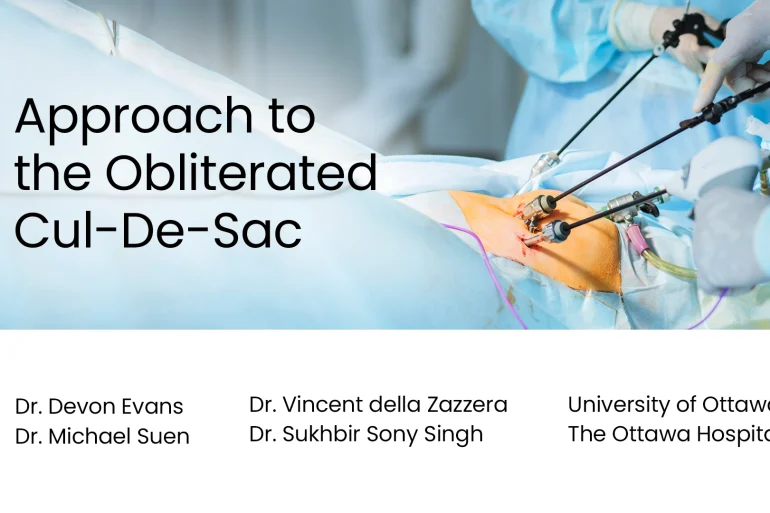 Approach to the Obliterated Cul-De-Sac