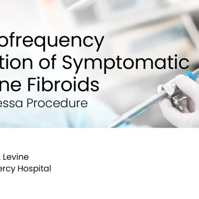 Radiofrequency Ablation of Symptomatic Uterine Fibroids: The Acessa Procedure preview