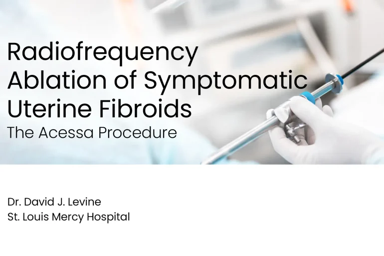 Radiofrequency Ablation of Symptomatic Uterine Fibroids: The Acessa Procedure preview