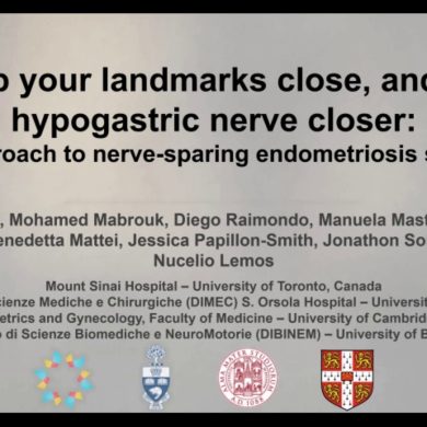 Keep Your Landmarks Close, and the Hypogastric Nerve Closer An Approach to Nerve-sparing Endometriosis