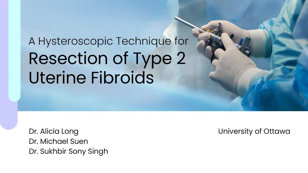 Video Of Technique For Resection Of Type 2 Uterine Fibroids 3895