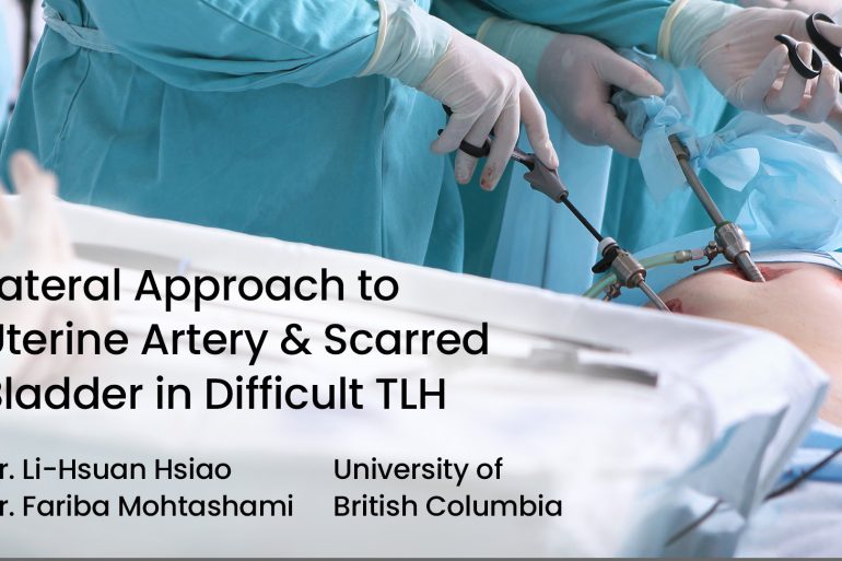 Lateral Approach to Uterine Artery & Scarred Bladder in Difficult TLH