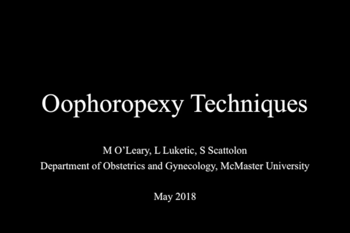Oopheropexy Techniques