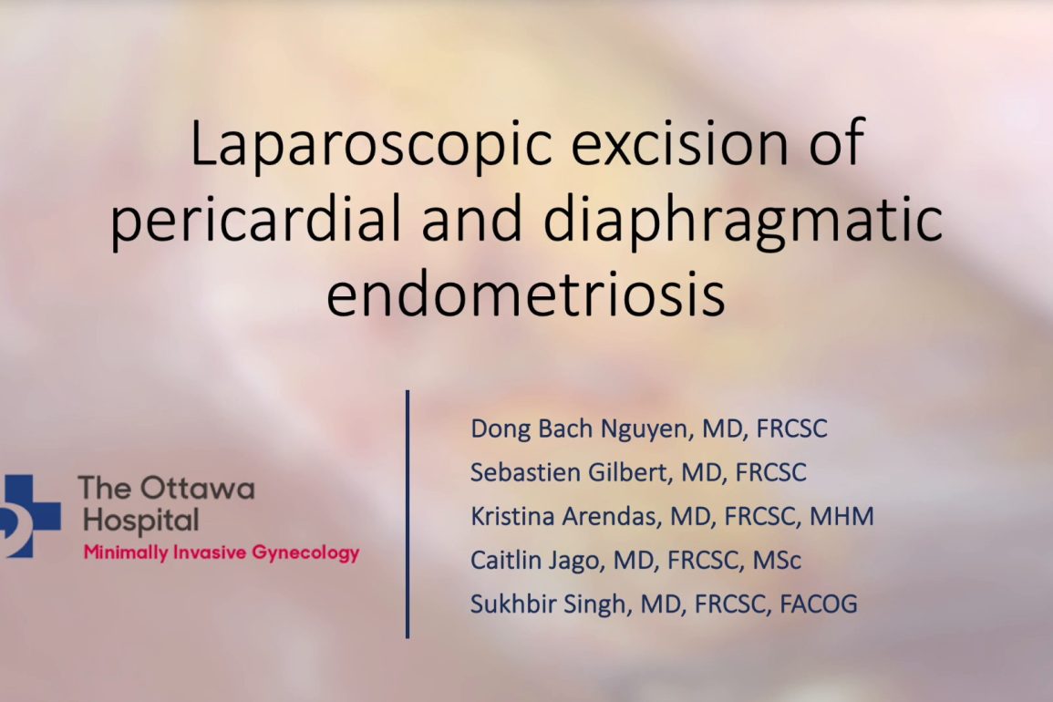 Laparoscopic Excision of Pericardial and Diaphragmatic Endometriosis