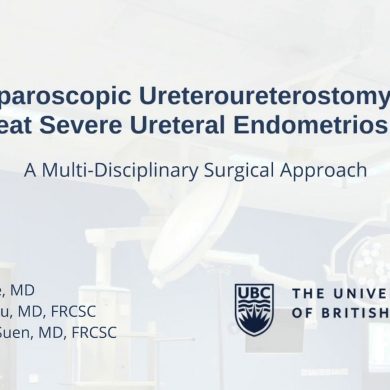 Laparoscopic Ureteroureterostomy to Treat Severe Ureteral Endometriosis
