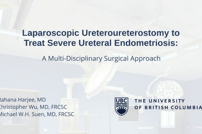 Ureteroureterostomy To Treat Severe Ureteral Endometriosis 5588