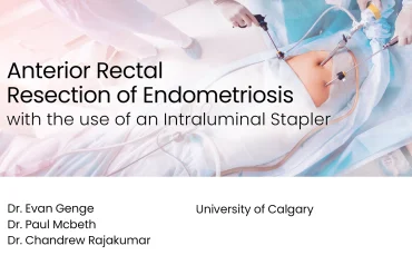 Anterior Rectal Resection of Endometriosis with the use of an Intraluminal Stapler