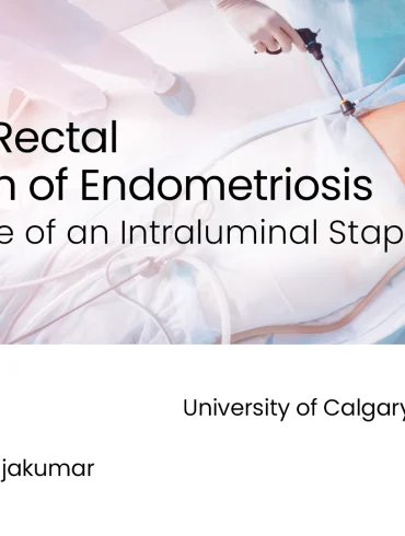 Anterior Rectal Resection of Endometriosis with the use of an Intraluminal Stapler