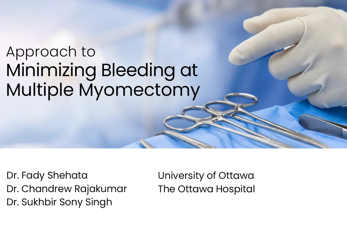Approach to Minimizing Bleeding at Multiple Myomectomy