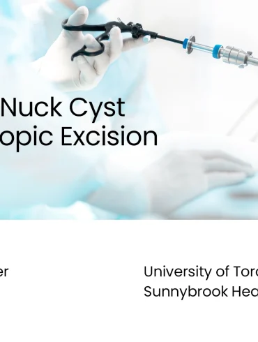 Canal Of Nuck Cyst Laparoscopic Excision