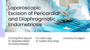 Laparoscopic Excision of Pericardial and Diaphragmatic Endometriosis preview