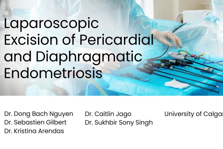 Laparoscopic Excision of Pericardial and Diaphragmatic Endometriosis preview