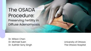 The OSADA Procedure: Preserving Fertility in Diffuse Adenomyosis Preview