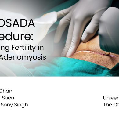 The OSADA Procedure: Preserving Fertility in Diffuse Adenomyosis Preview