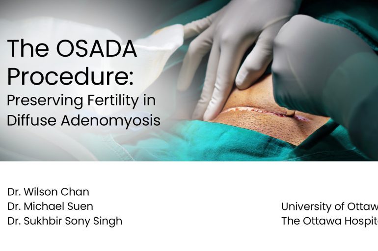 The OSADA Procedure: Preserving Fertility in Diffuse Adenomyosis Preview