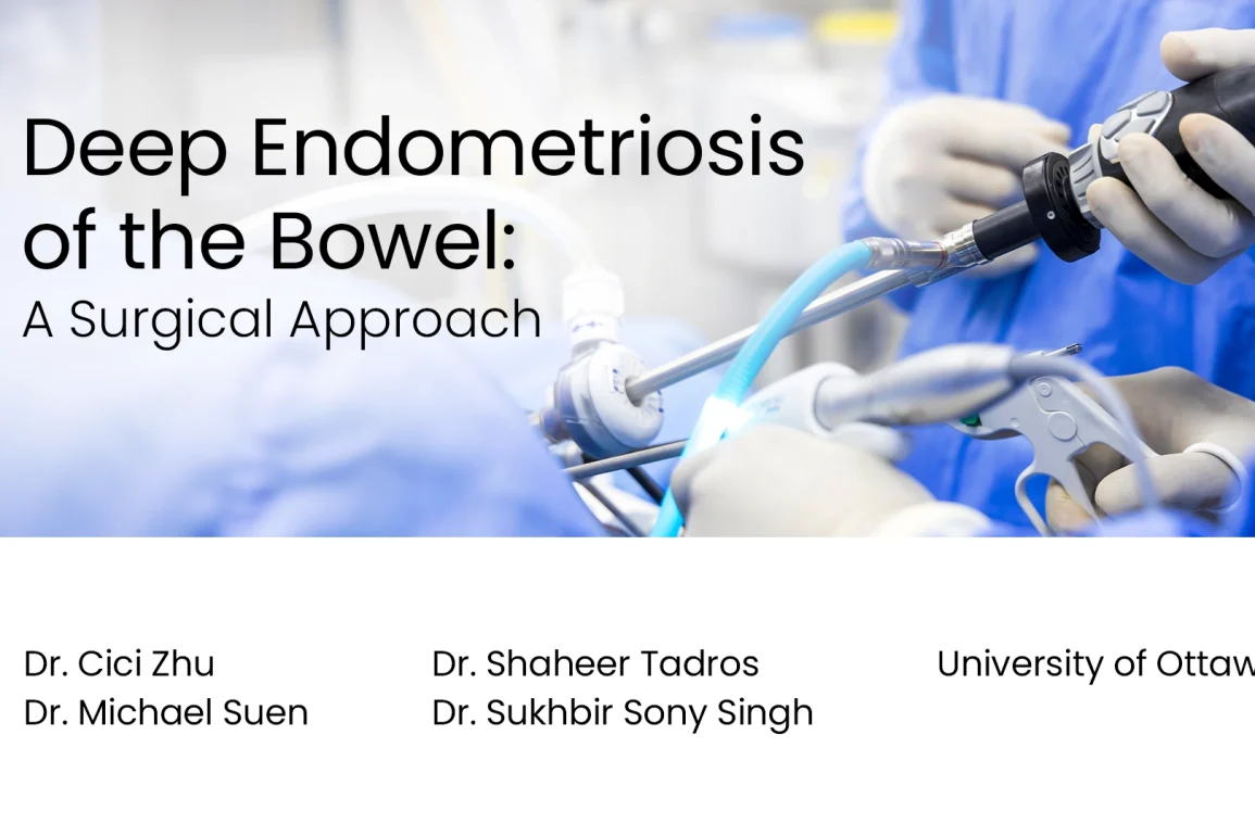 Deep Endometriosis of the Bowel: A Surgical Approach