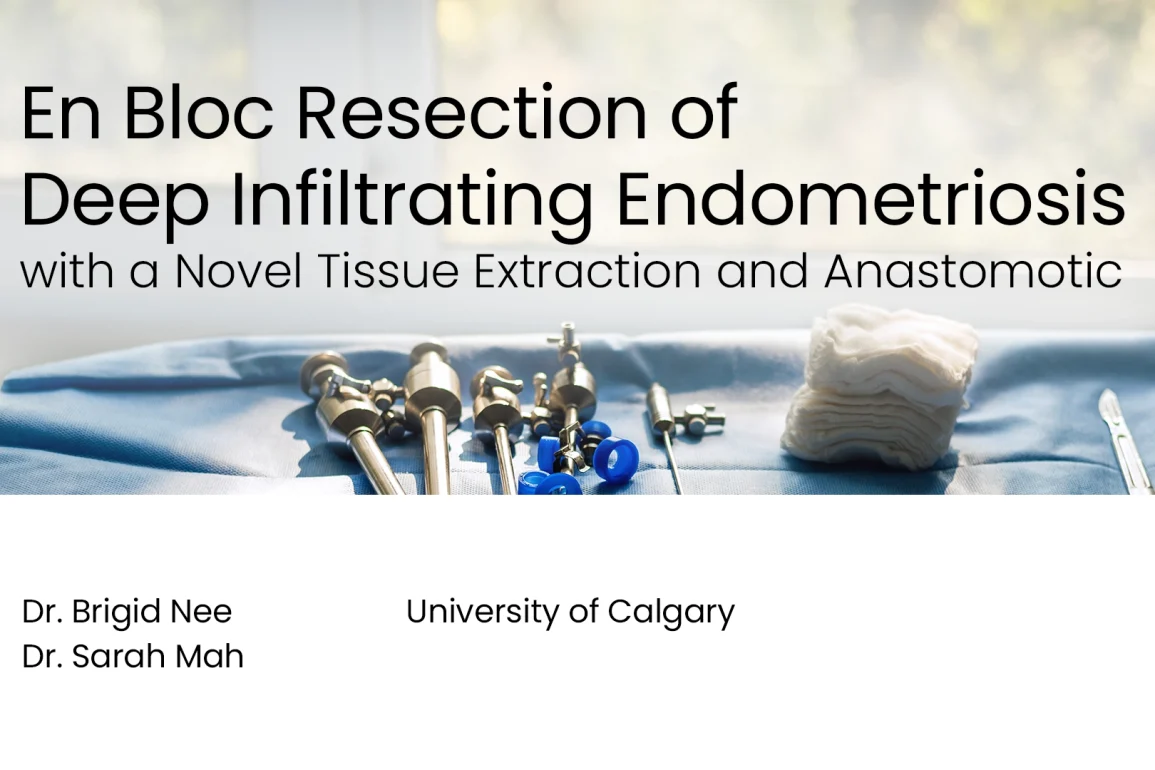 En Bloc Resection of Deep Infiltrating Endometriosis with a Novel Tissue Extraction and Anastomotic