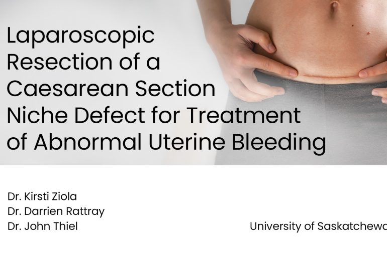 woman with a scar on her stomach