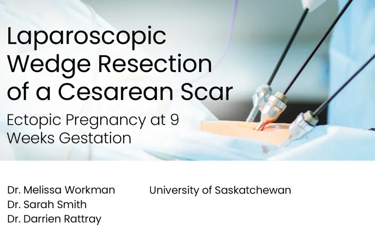 Laparoscopic Wedge Resection of a Cesarean Scar Ectopic Pregnancy at 9 Weeks Gestation