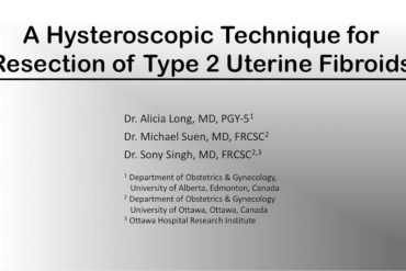 A Hysteroscopic Technique for Resection of Type 2 Uterine Fibroids