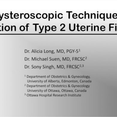 A Hysteroscopic Technique for Resection of Type 2 Uterine Fibroids