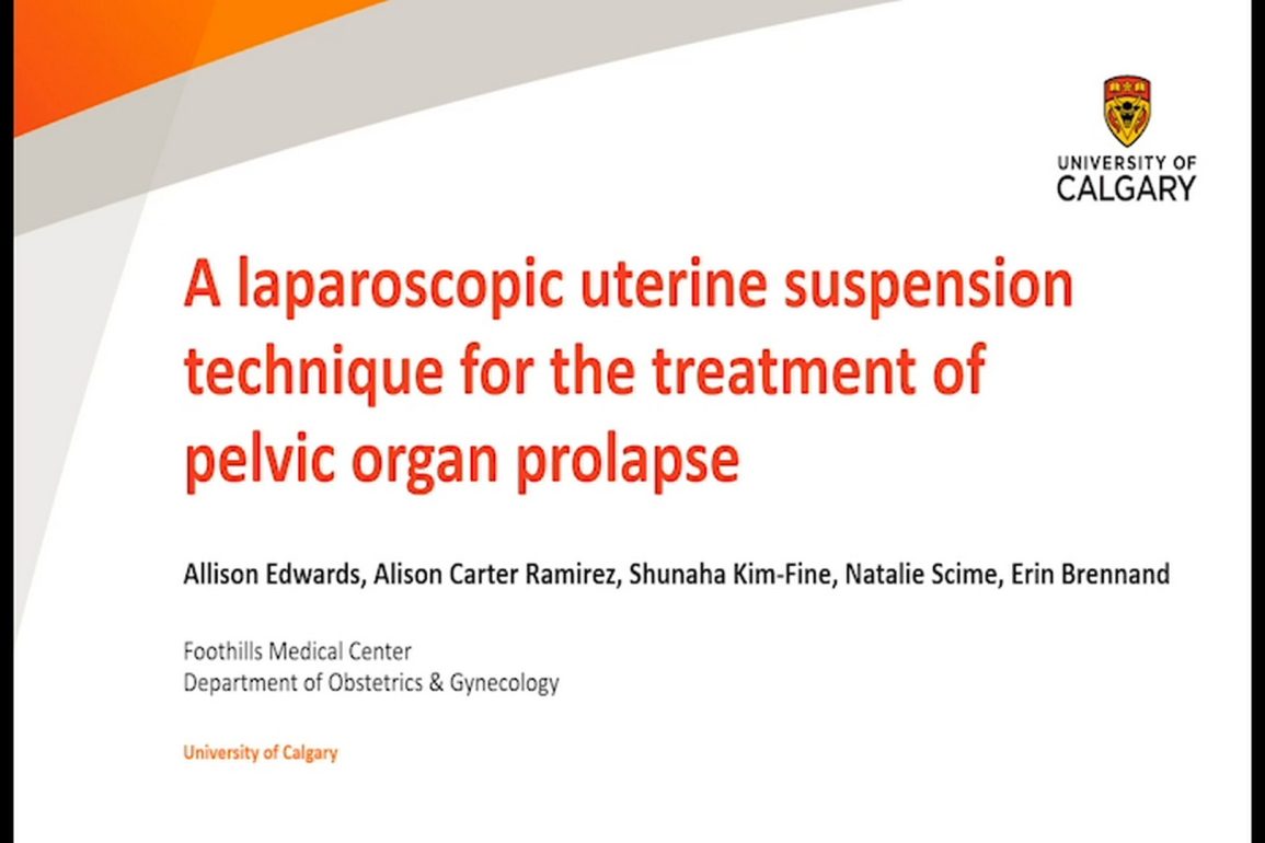 A Laparoscopic Uterine Suspension Technique for the Treatment of Pelvic Organ Prolapse