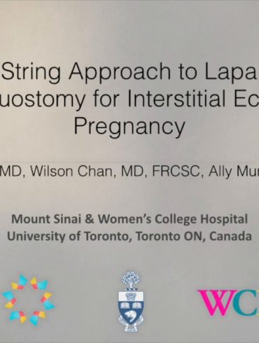 A Purse-String Approach to Laparoscopic Cornuostomy for Interstitial Ectopic Pregnancy