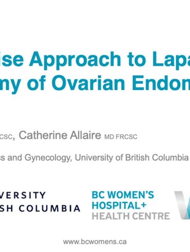 A Step-wise Approach to Laparoscopic Cystectomy of Ovarian Endometrioma